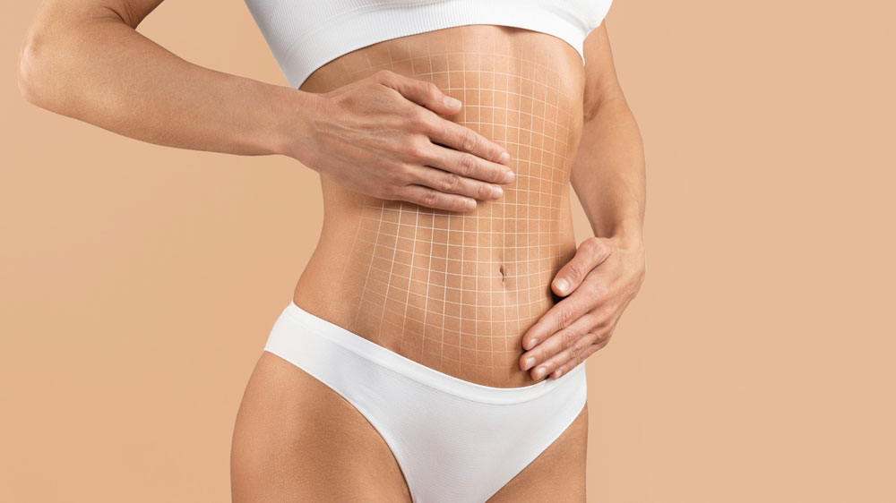 tummy tuck demonstration